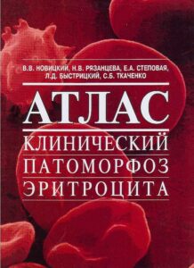 ATLAS Klinicheskij Patomorfoz Eritrocita